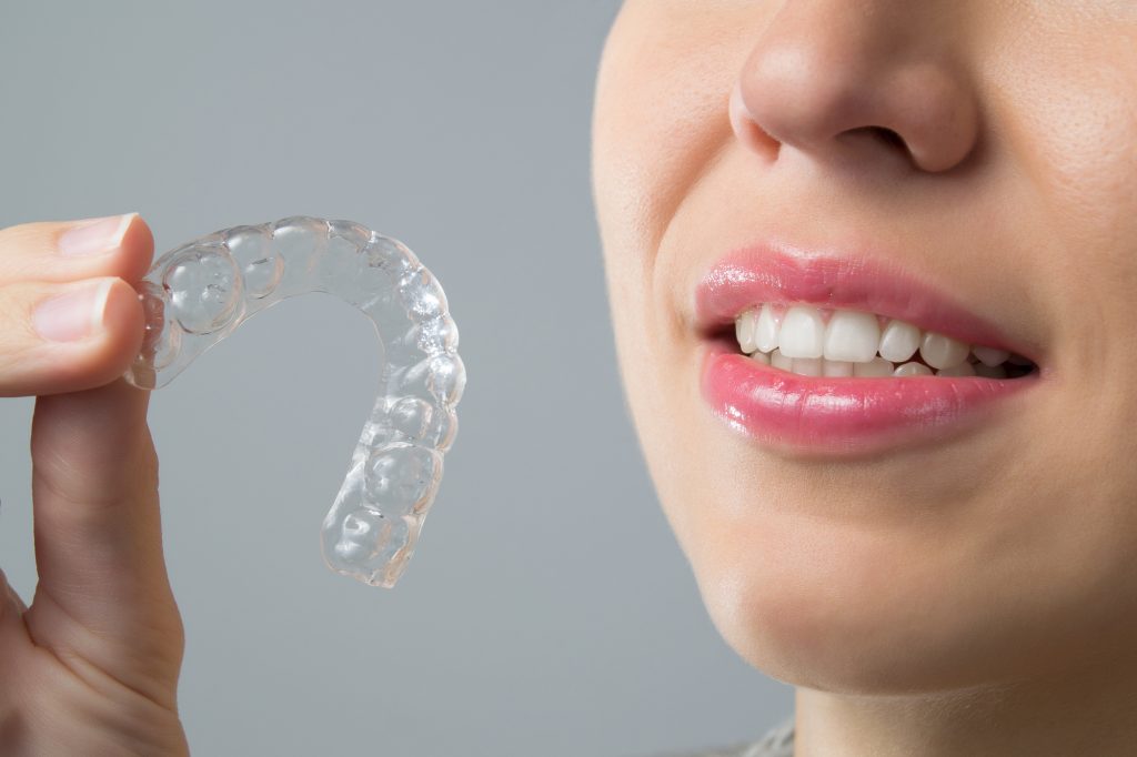 How to Get the Best Price on Invisalign