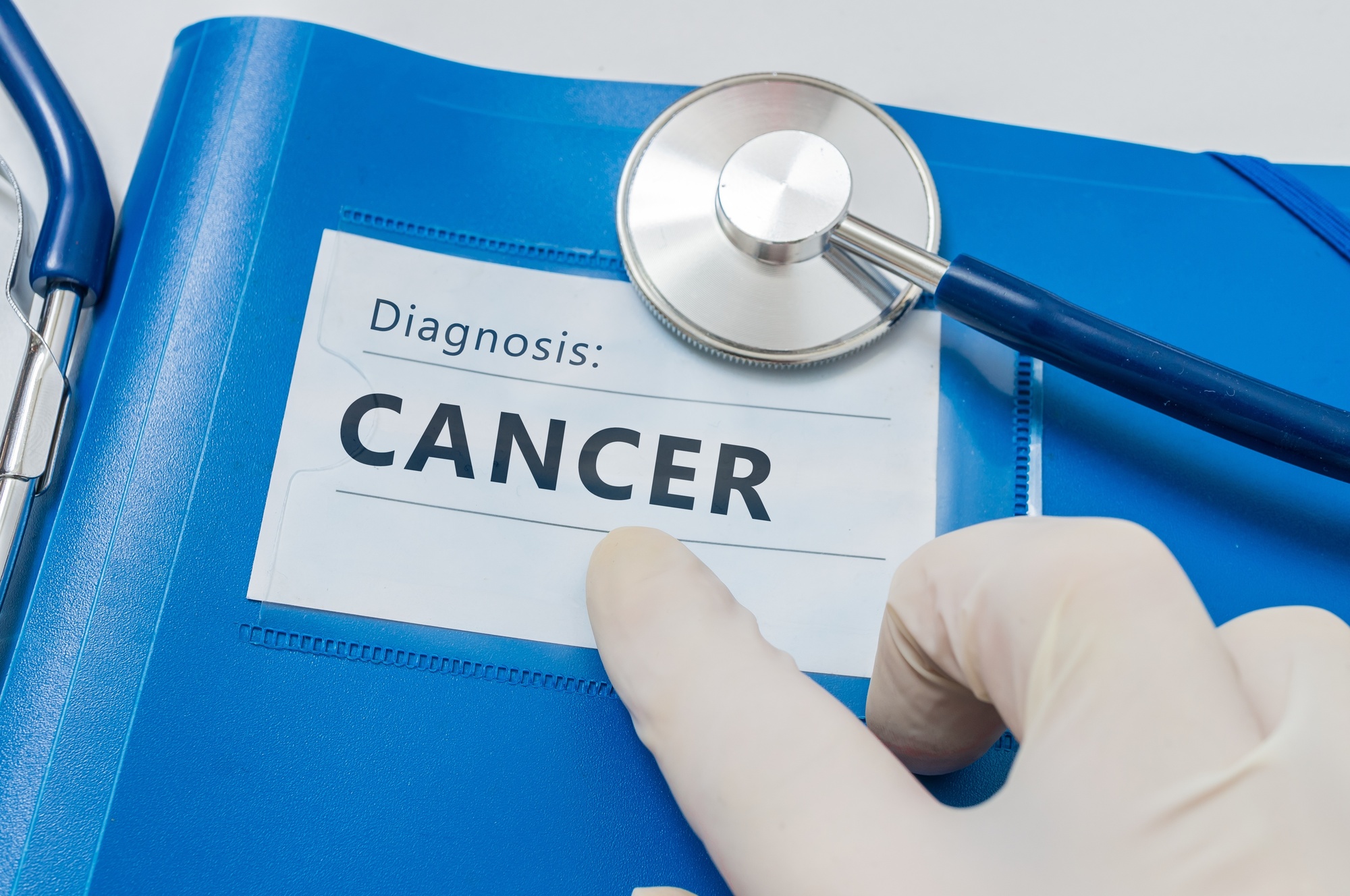 Coping With a Cancer Diagnosis